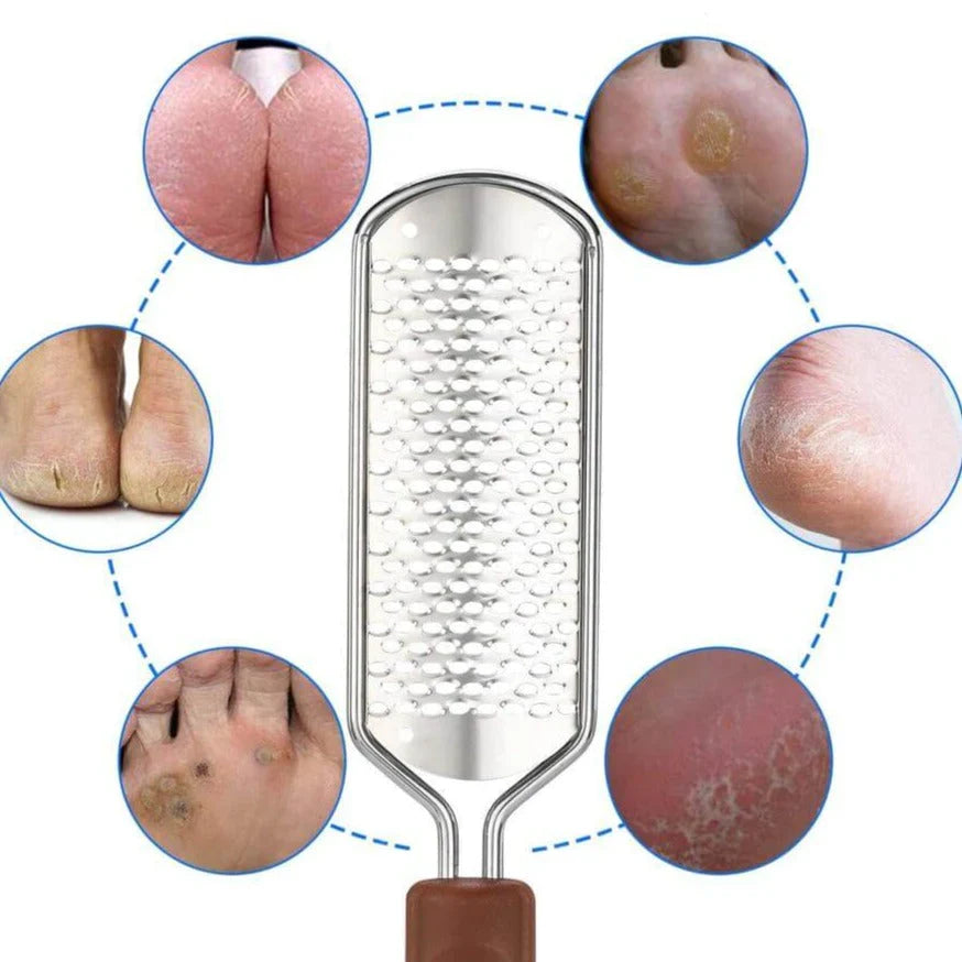 Professional Foot File Callus Remover