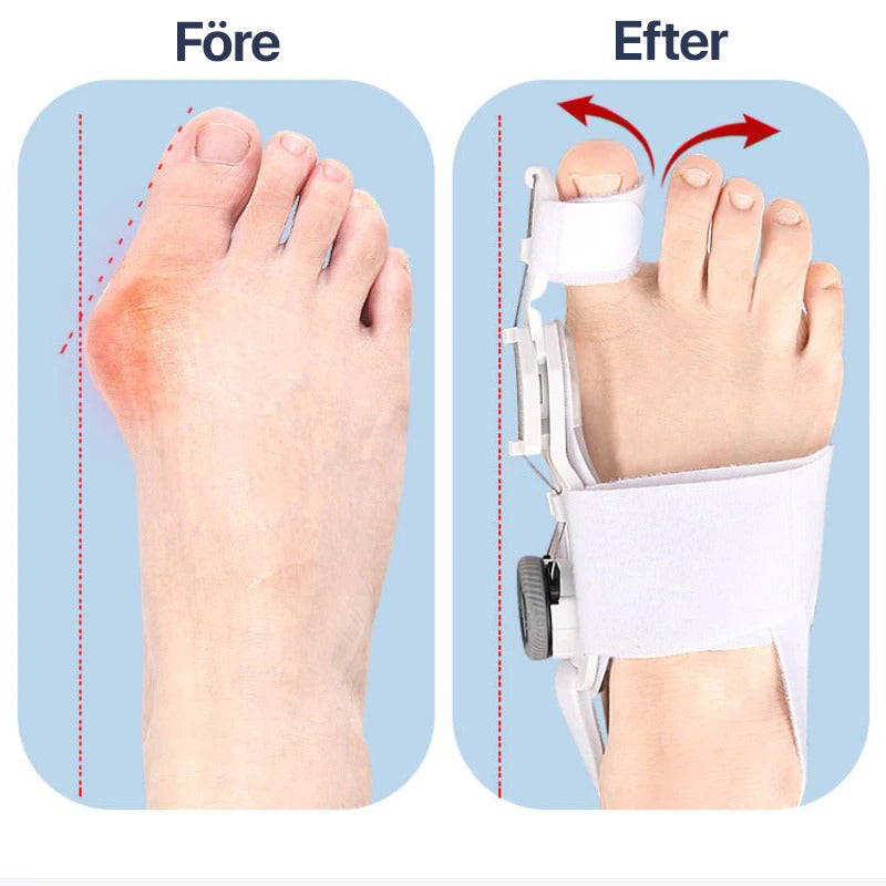 Hallux Valgus Toe Corrector with Adjustable Support