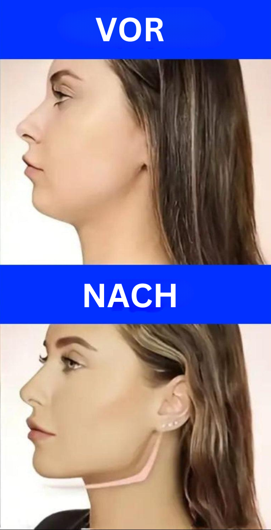 Jawline Exerciser