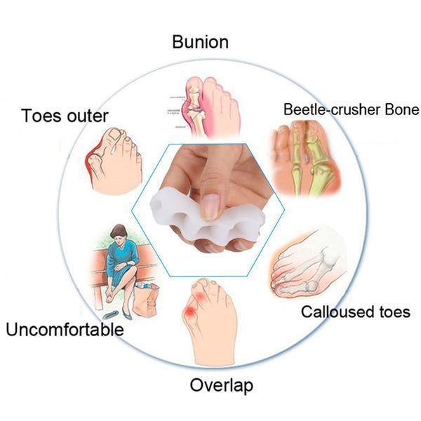 Orthopedic Toe Corrector and Toe Separator