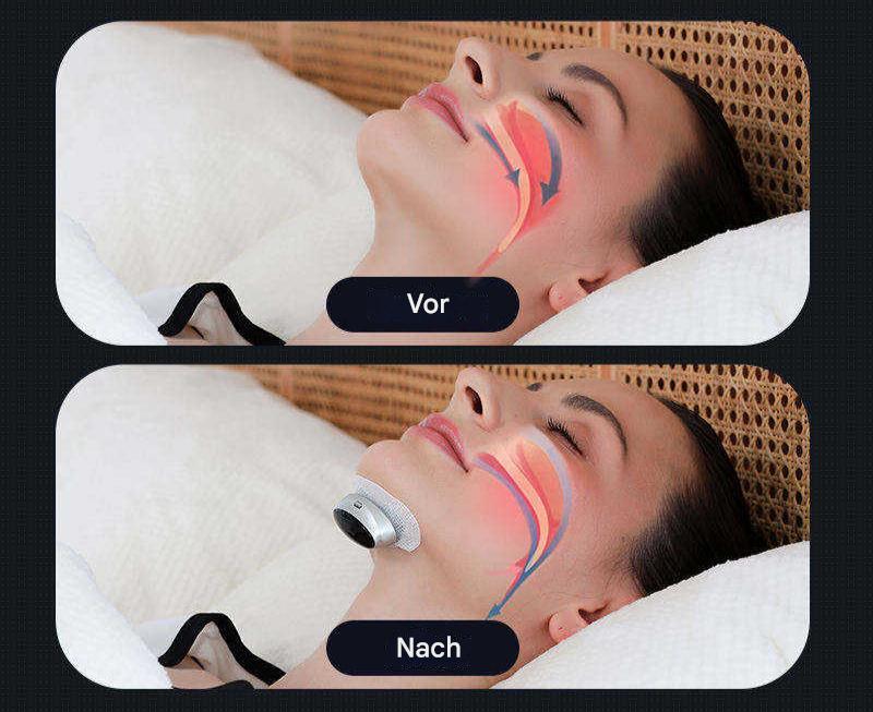 Sleep Apnea Aid